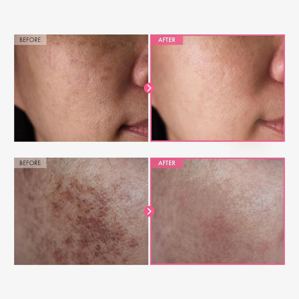 Korean Arbutin Dark Spot Correcting Cream